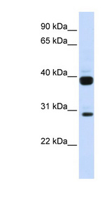 FLT3LG / Flt3 Ligand antibody LS-C111007 Western blot of Fetal Muscle lysate.