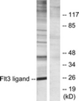Western blot of extracts from Jurkat cells, using Flt3 ligand Antibody. The lane on the right is treated with the synthesized peptide.