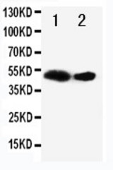 WB of FLT3LG / FLT3L / Flt3 Ligand antibody. Recombinant Protein Detection Source:. E.coli derived -recombinant Human FLT3LG, 40.7KD. (162aa tag+P36-H235). . Lane 1: Recombinant Human FLT3LG Protein 10ng. Lane 2: Recombinant Human FLT3LG Protein 5ng.