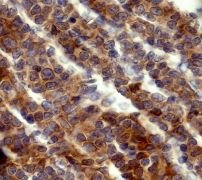 IHC of paraffin-embedded human tonsils using anti-Flt3-L antibody.