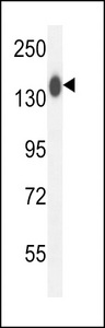 COL19A1 Antibody western blot of mouse kidney tissue lysates (35 ug/lane). The COL19A1 antibody detected the COL19A1 protein (arrow).