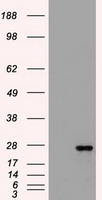 HEK293T cells were transfected with the pCMV6-ENTRY control (Left lane) or pCMV6-ENTRY FLT3LG (Right lane) cDNA for 48 hrs and lysed. Equivalent amounts of cell lysates (5 ug per lane) were separated by SDS-PAGE and immunoblotted with anti-FLT3LG.