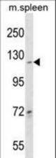 COL19A1 Antibody western blot of mouse spleen tissue lysates (35 ug/lane). The COL19A1 antibody detected the COL19A1 protein (arrow).