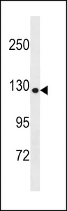 COL19A1 Antibody western blot of Uterus tissue lysates (35 ug/lane). The COL19A1 antibody detected the COL19A1 protein (arrow).