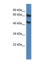 FLVCR1 / FLVCR antibody LS-C145390 Western blot of Mouse Brain lysate. Antibody concentration 1 ug/ml.