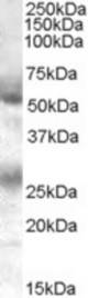 Antibody (0.1 ug/ml) staining of Human Bone Marrow lysate (35 ug protein in RIPA buffer). Primary incubation was 1 hour. Detected by chemiluminescence.