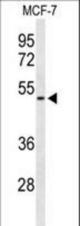 Western blot of FLVC2 Antibody in MCF-7 cell line lysates (35 ug/lane). FLVC2 (arrow) was detected using the purified antibody.
