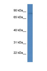 FLYWCH1 antibody LS-C135796 Western blot of Fetal Kidney lysate. Antibody concentration 1 ug/ml.