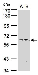 Sample (30 ug whole cell lysate). A: Hep G2 , B: Raji . 7.5% SDS PAGE. FMO1 antibody diluted at 1:1000