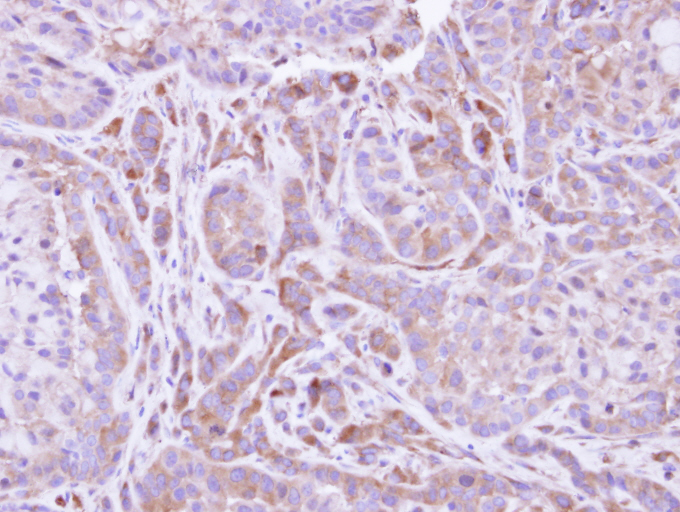 IHC of paraffin-embedded A549 xenograft using FMO2 antibody at 1:500 dilution.