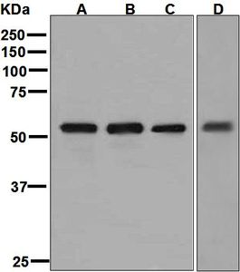 Western blot analysis on (A) rat kidney, (B) mouse liver, (C) rat liver, and (D) fetal liver lysates using anti-FMO3 antibody.