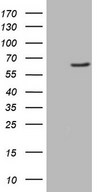 HEK293T cells were transfected with the pCMV6-ENTRY control (Left lane) or pCMV6-ENTRY FMO3 (Right lane) cDNA for 48 hrs and lysed. Equivalent amounts of cell lysates (5 ug per lane) were separated by SDS-PAGE and immunoblotted with anti-FMO3 (1:2000).