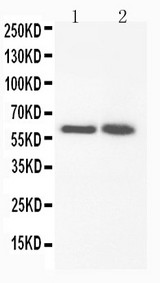 WB of FMO3 antibody. All lanes: Anti-FMO3 at 0.5ug/ml. Lane 1: Rat Liver Tissue Lysate at 40ug. Lane 2: Rat Liver Tissue Lysate at 40ug. Predicted bind size: 60KD. Observed bind size: 60KD.