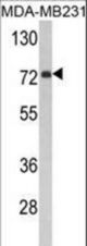 Western blot of FMO3 Antibody in MDA-MB231 cell line lysates (35 ug/lane). FMO3 (arrow) was detected using the purified antibody.