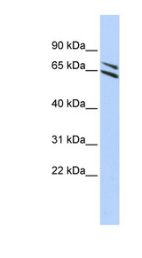 FMO4 antibody LS-C111012 Western blot of HepG2 cell lysate.