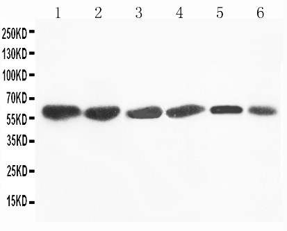 WB of FMO4 antibody. All lanes: Anti-FMO4 at 0.5ug/ml. Lane 1: Rat Liver Tissue Lysate at 40ug. Lane 2: Mouse Liver Tissue Lysate at 40ug. Lane 3: SMMC Whole Cell Lysate at 40ug. Lane 4: HEPA Whole Cell Lysate at 40ug. Lane 5: A431 Whole Cell Lysate at 40ug. Lane 6: MCF-7 Whole Cell Lysate at 40ug. Predicted bind size: 63KD. Observed bind size: 63KD.