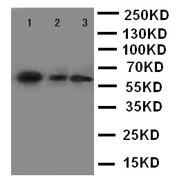 WB of FMO5 antibody. Lane 1: Mouse Liver Tissue Lysate. Lane 2: Mouse Testis Tissue Lysate. Lane 3: Mouse Spleen Tissue Lysate..