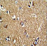 Formalin-fixed and paraffin-embedded human brain tissue reacted with FMR1 Antibody , which was peroxidase-conjugated to the secondary antibody, followed by DAB staining. This data demonstrates the use of this antibody for immunohistochemistry; clinical relevance has not been evaluated.