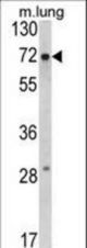 Western blot of FMR1 Antibody in mouse lung tissue lysates (35 ug/lane). FMR1 (arrow) was detected using the purified antibody.