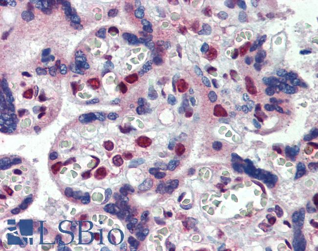 Anti-FMR1 antibody IHC of human placenta. Immunohistochemistry of formalin-fixed, paraffin-embedded tissue after heat-induced antigen retrieval. Antibody LS-B3970 concentration 2.5 ug/ml.