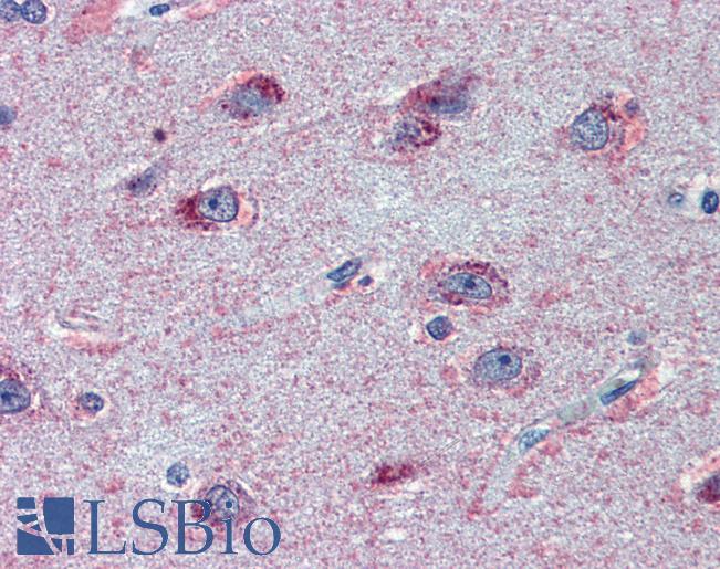 Anti-FMR1 antibody IHC of human brain, cortex. Immunohistochemistry of formalin-fixed, paraffin-embedded tissue after heat-induced antigen retrieval. Antibody LS-B3970 concentration 2.5 ug/ml.