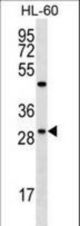 FMR1NB Antibody western blot of HL-60 cell line lysates (35 ug/lane). The FMR1NB antibody detected the FMR1NB protein (arrow).