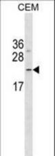 FNDC4 Antibody western blot of CEM cell line lysates (35 ug/lane). The FNDC4 antibody detected the FNDC4 protein (arrow).