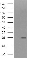 HEK293T cells were transfected with the pCMV6-ENTRY control (Left lane) or pCMV6-ENTRY FNDC4 (Right lane) cDNA for 48 hrs and lysed. Equivalent amounts of cell lysates (5 ug per lane) were separated by SDS-PAGE and immunoblotted with anti-FNDC4.