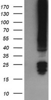 HEK293T cells were transfected with the pCMV6-ENTRY control (Left lane) or pCMV6-ENTRY FNDC4 (Right lane) cDNA for 48 hrs and lysed. Equivalent amounts of cell lysates (5 ug per lane) were separated by SDS-PAGE and immunoblotted with anti-FNDC4.