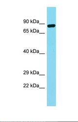 Western blot of Fetal Brain. FNDC7 antibody dilution 1.0 ug/ml.