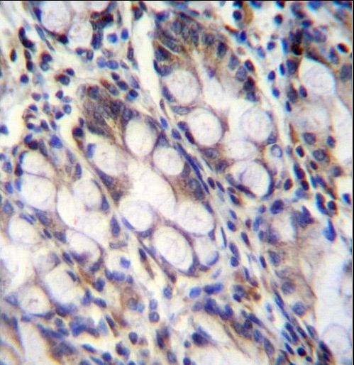 FNDC7 Antibody immunohistochemistry of formalin-fixed and paraffin-embedded human rectum tissue followed by peroxidase-conjugated secondary antibody and DAB staining.