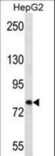 FNDC7 Antibody western blot of HepG2 cell line lysates (35 ug/lane). The FNDC7 antibody detected the FNDC7 protein (arrow).