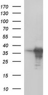 HEK293T cells were transfected with the pCMV6-ENTRY control (Left lane) or pCMV6-ENTRY FNDC8 (Right lane) cDNA for 48 hrs and lysed. Equivalent amounts of cell lysates (5 ug per lane) were separated by SDS-PAGE and immunoblotted with anti-FNDC8.