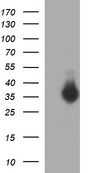 HEK293T cells were transfected with the pCMV6-ENTRY control (Left lane) or pCMV6-ENTRY FNDC8 (Right lane) cDNA for 48 hrs and lysed. Equivalent amounts of cell lysates (5 ug per lane) were separated by SDS-PAGE and immunoblotted with anti-FNDC8.