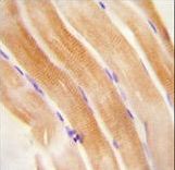 FNIP2 antibody immunohistochemistry of formalin-fixed and paraffin-embedded human skeletal muscle followed by peroxidase-conjugated secondary antibody and DAB staining.