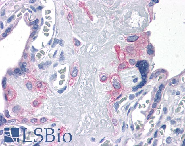 Anti-FNIP2 antibody IHC of human placenta. Immunohistochemistry of formalin-fixed, paraffin-embedded tissue after heat-induced antigen retrieval. Antibody LS-B4600 concentration 5 ug/ml.