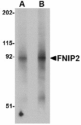 Western blot of FNIP2 in mouse skeletal muscle lysate with FNIP2 antibody at (A) 1 and (B) 2 ug/ml.