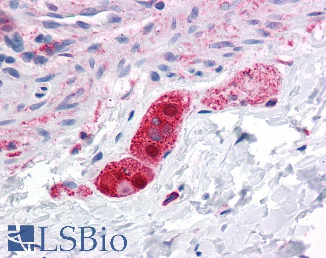 Anti-FNIP2 antibody IHC of human colon, submucosal plexus. Immunohistochemistry of formalin-fixed, paraffin-embedded tissue after heat-induced antigen retrieval. Antibody LS-B4598 concentration 5 ug/ml.