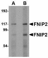 Western blot of FNIP2 in rat skeletal muscle lysate with FNIP2 antibody at (A) 1 and (B) 2 ug/ml.