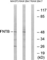 Western blot of extracts from RAW264.7/NIH-3T3 cells, using FNTB Antibody. The lane on the right is treated with the synthesized peptide.