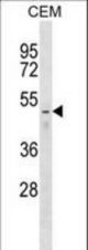 FNTB Antibody western blot of CEM cell line lysates (35 ug/lane). The FNTB antibody detected the FNTB protein (arrow).