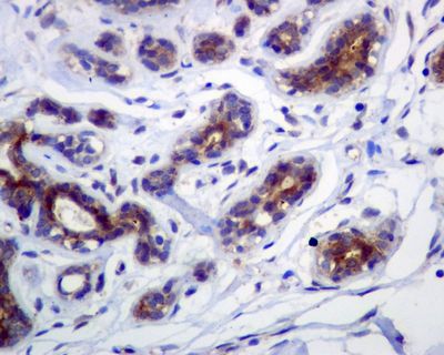 IHC of paraffin-embedded human breast tissue using anti-FNTB antibody.
