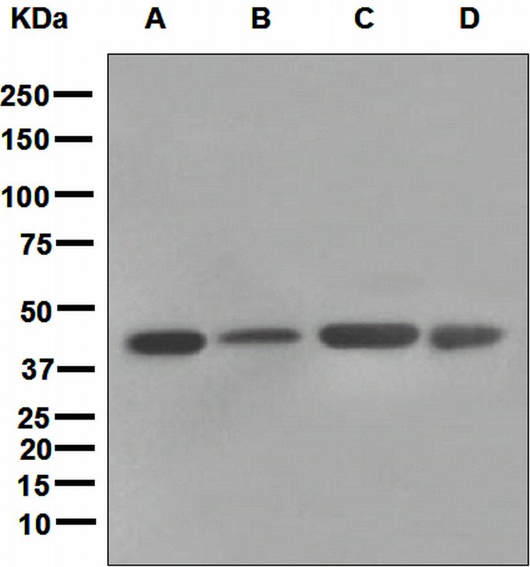 Western blot analysis on (A) JAR, (B) A431, (C) U87-MG, and (D) A375 cell lysates using anti-FNTB antibody.