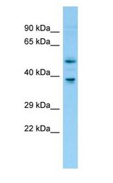 FNTB antibody Western Blot of Rat Thymus.
