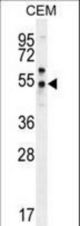 PSMAL Antibody western blot of CEM cell line lysates (35 ug/lane). The PSMAL antibody detected the PSMAL protein (arrow).