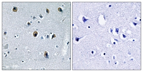 IHC of paraffin-embedded human brain tissue, using Collagen XX alpha1 Antibody. The picture on the right is treated with the synthesized peptide.
