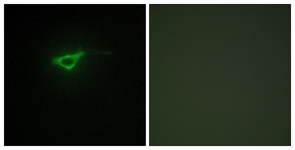 Immunofluorescence of NIH-3T3 cells, using Collagen XX alpha1 Antibody. The picture on the right is treated with the synthesized peptide.