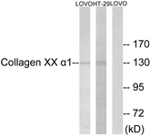 Western blot of extracts from LOVO/HT-19 cells, using Collagen XX alpha1 Antibody. The lane on the right is treated with the synthesized peptide.