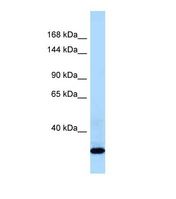 Western blot of Human Fetal Liver. COL21A1 antibody dilution 1.0 ug/ml.