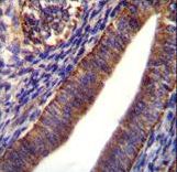COL21A1 Antibody immunohistochemistry of formalin-fixed and paraffin-embedded human uterus tissue followed by peroxidase-conjugated secondary antibody and DAB staining.